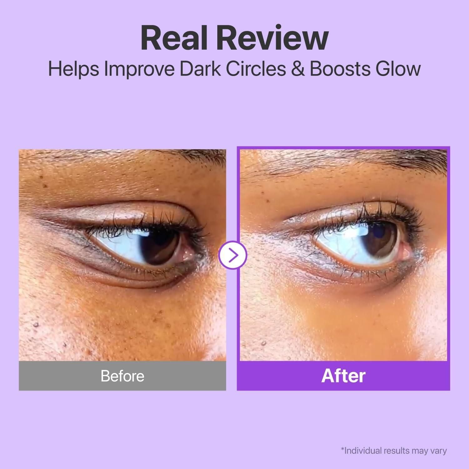 Volumetox Eye Cream 100 gm